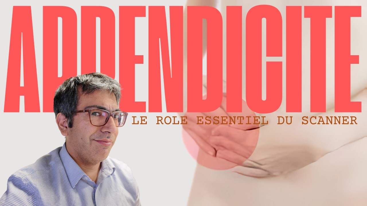 Appendicite : le r&ocirc;le essentiel du SCANNER avec un exemple parlant !