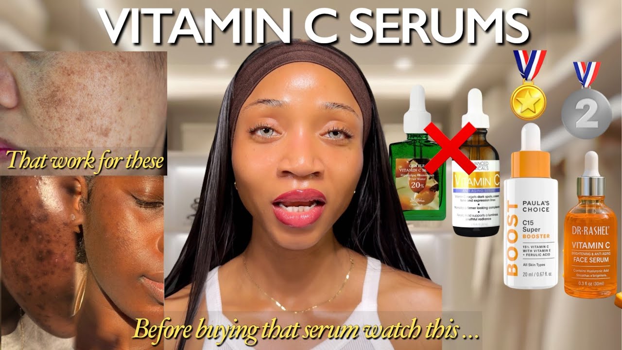 Choose the RIGHT Vitamin C Serum for you | the real reason why your Dark Spots are not fading !