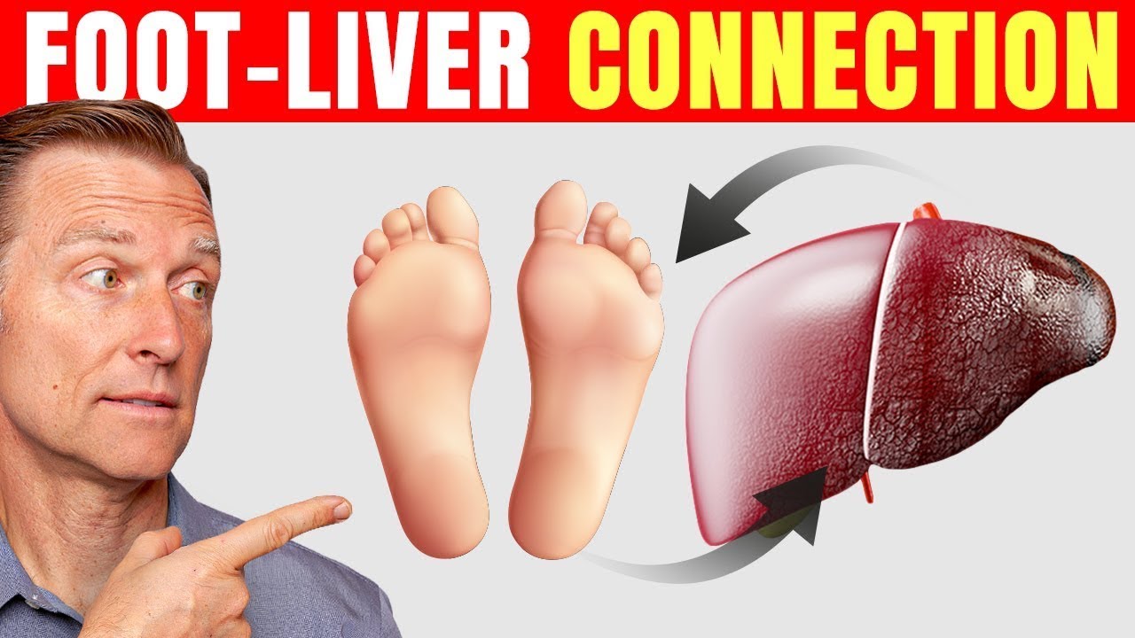 How to Use Your Feet to Diagnose Liver Problems&mdash;Dr. Berg Explains