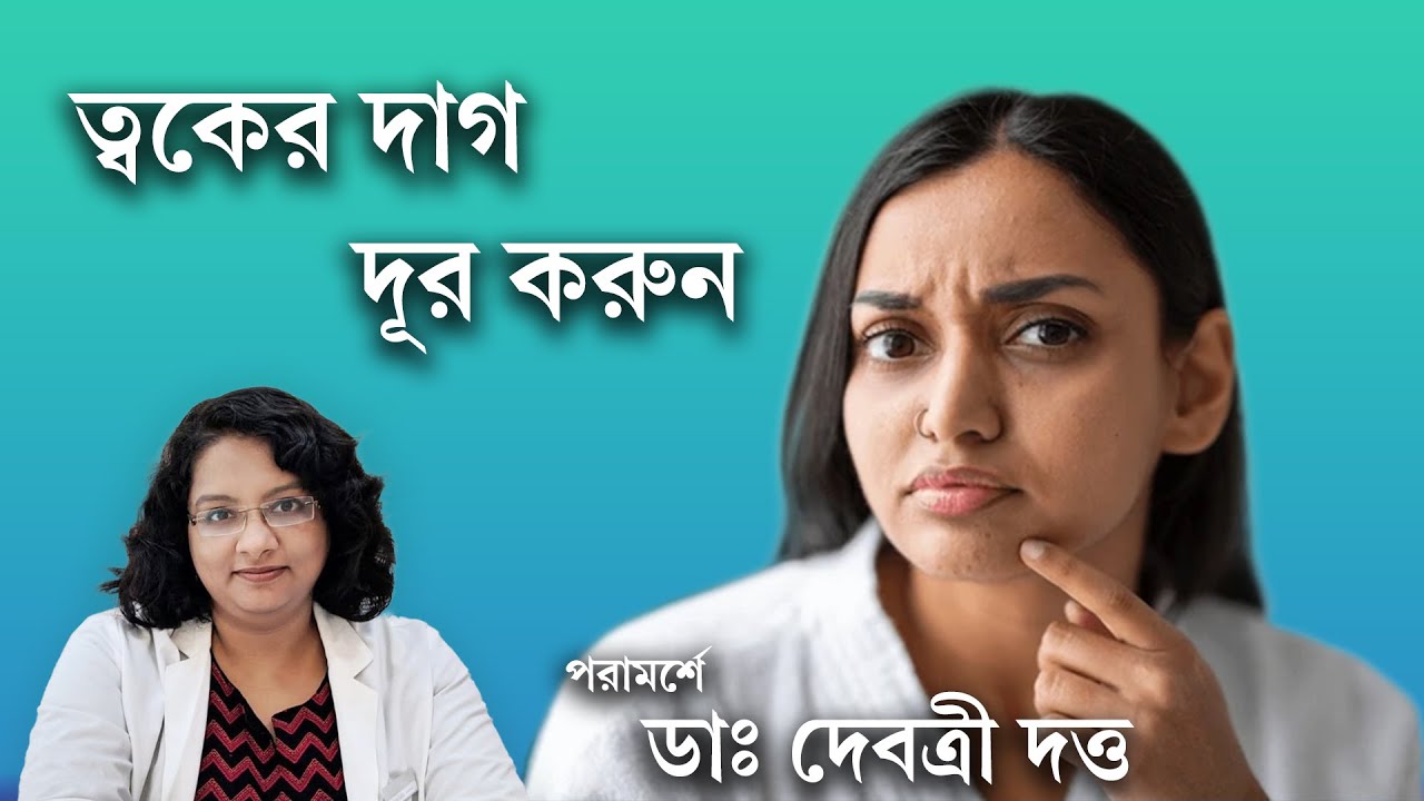 গ্লাইকোলিক অ্যাসিড ব্যবহার করার সঠিক নিয়ম | How to use glycolic acid for flawless skin
