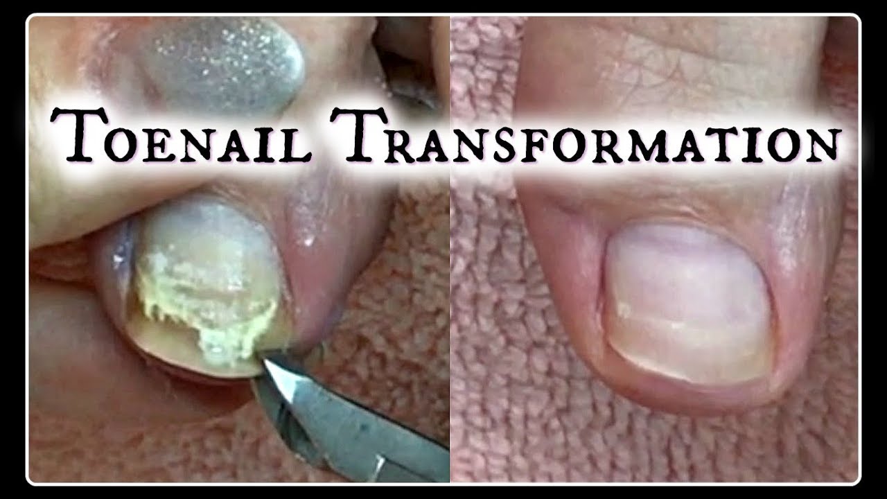 Pedicure Tutorial Toenail Transformation and Time Saving Tips  ✔