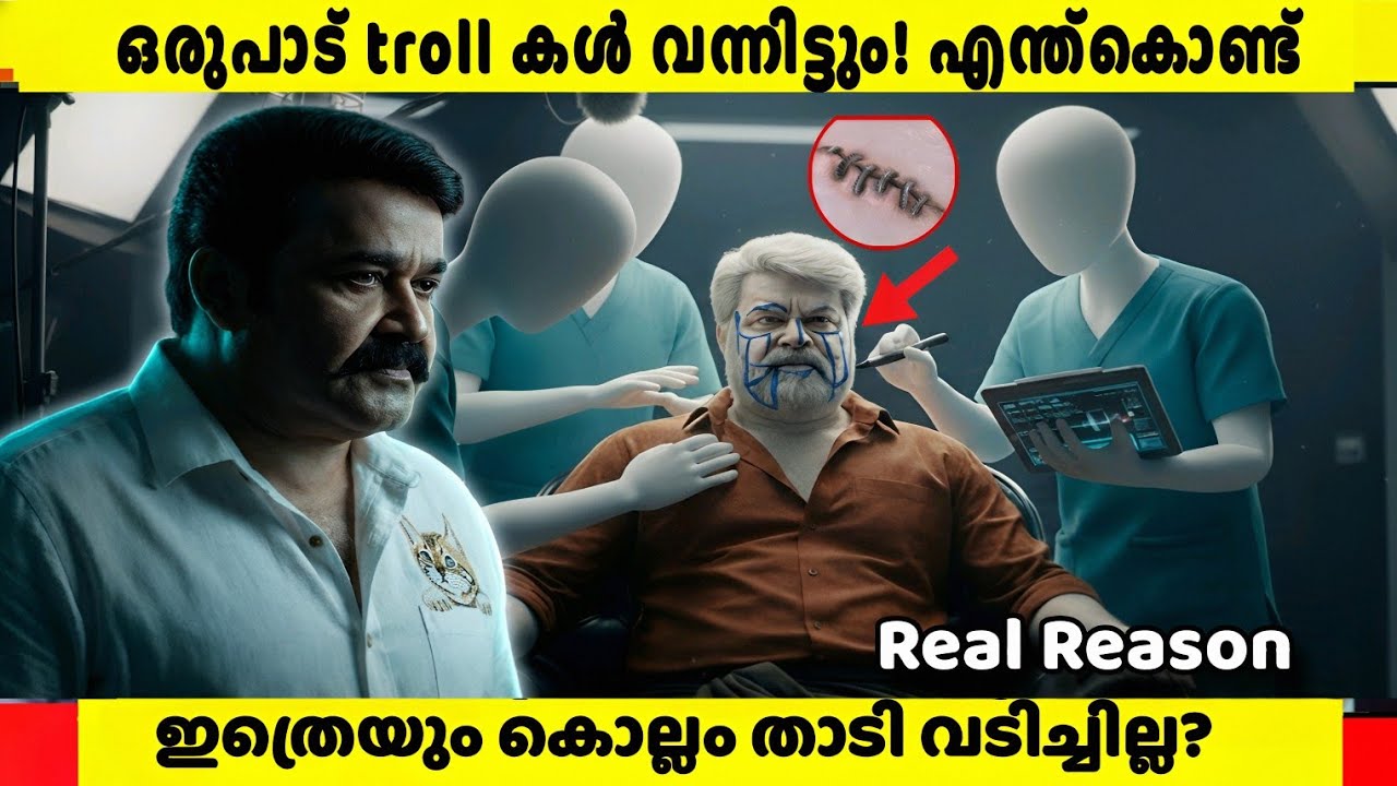 Why He Refused to Shave Despite Years of Trolls