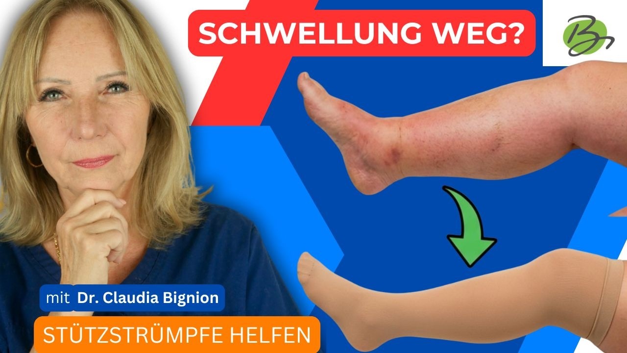 Wann ist Kompressionstherapie sinnvoll? &ndash; Indikationen einfach erkl&auml;rt | Dr. Claudia Bignion
