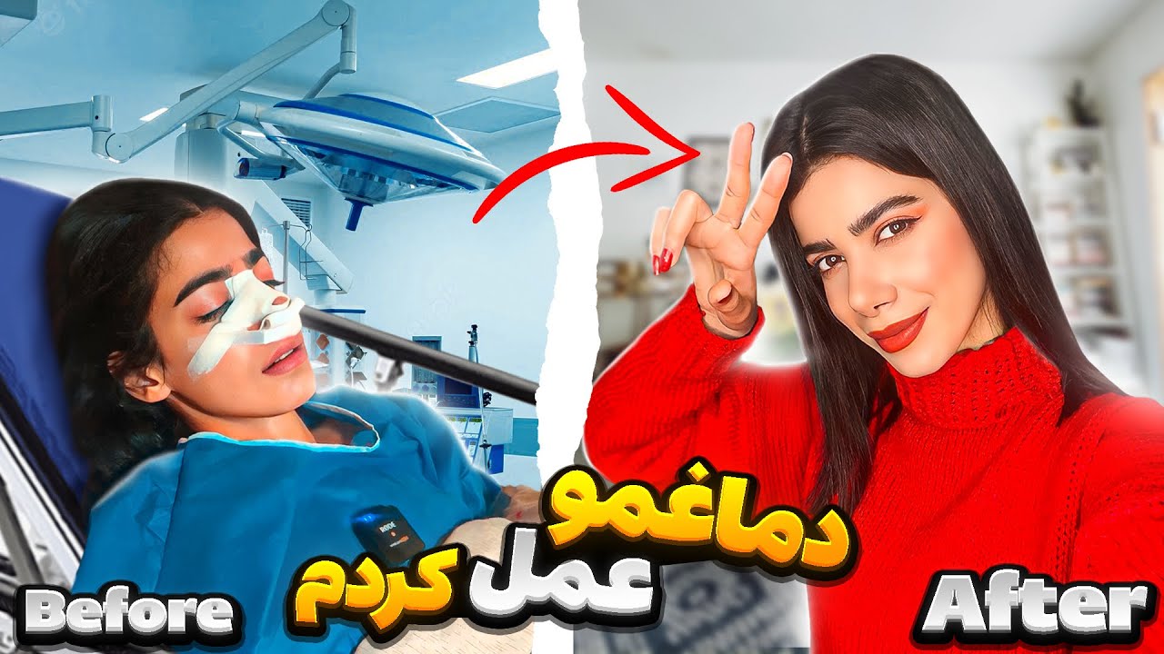 دماغمو عمل کردم 😁 همه چی و توضیح دادم