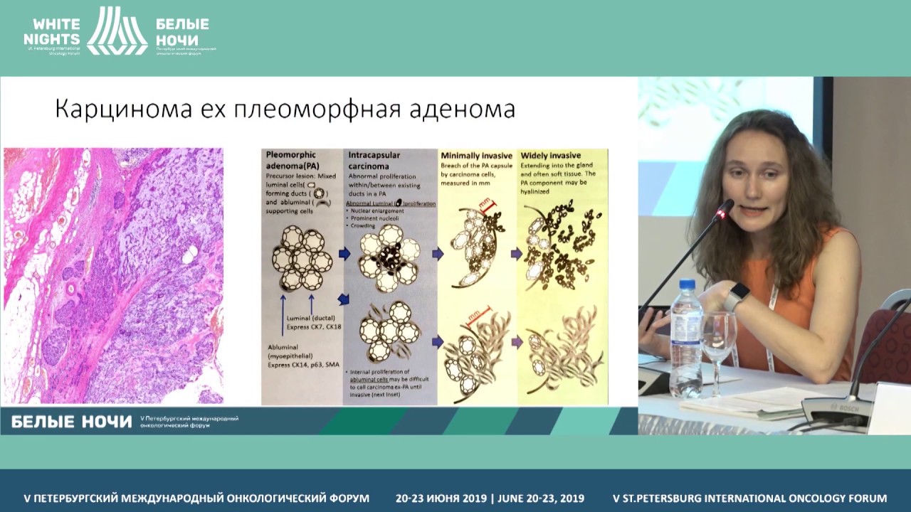 Слюнные железы, морфологическая характеристика (Артемьева А.С.)