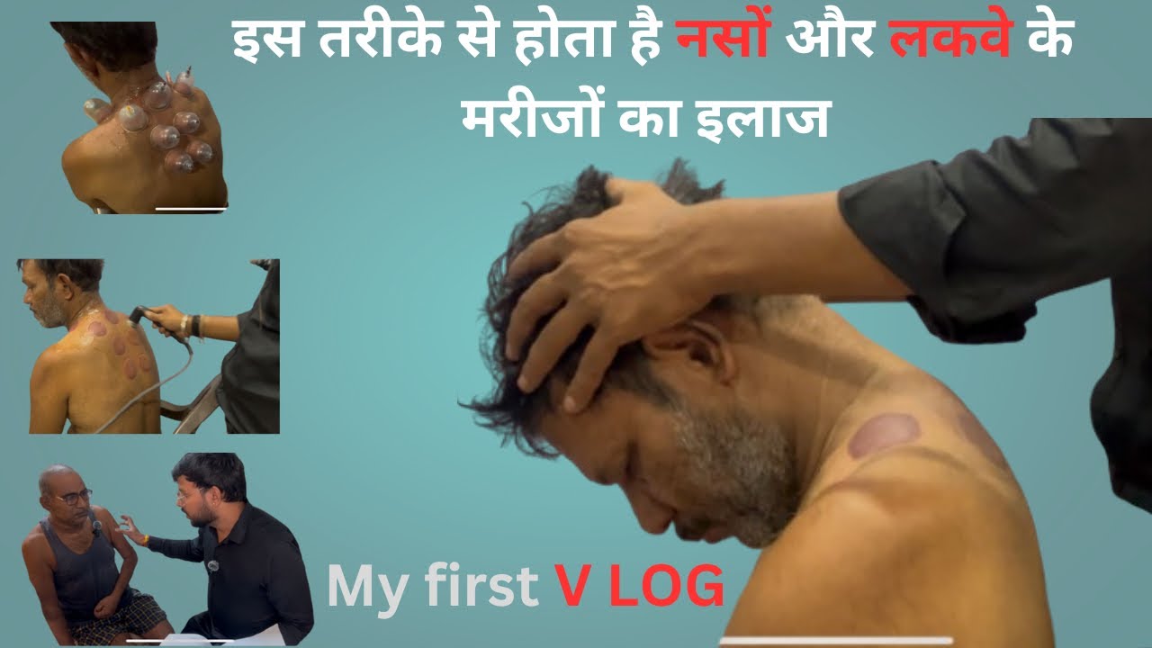 Paralysis treatment scheduleof Dr.Sumit soraiya#strokepatient#doctor #cerebellumstroke#physiotherapy