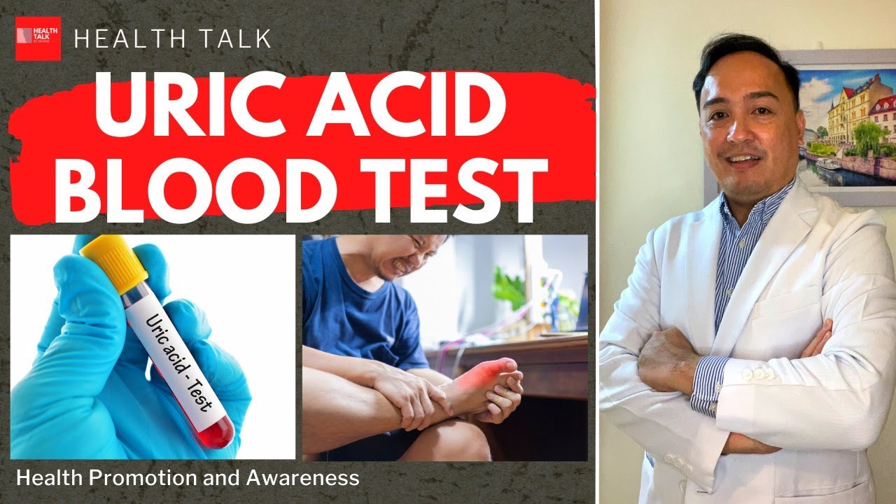 Uric Acid Test: What does it mean? Indications and Results