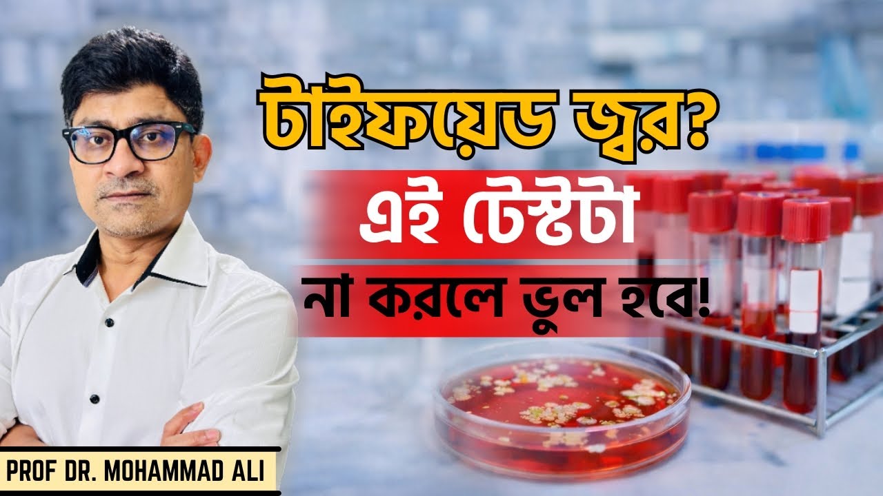 টাইফয়েড জ্বর প্রতিরোধ ও চিকিৎসার সম্পূর্ণ গাইড | Typhoid Fever Treatment