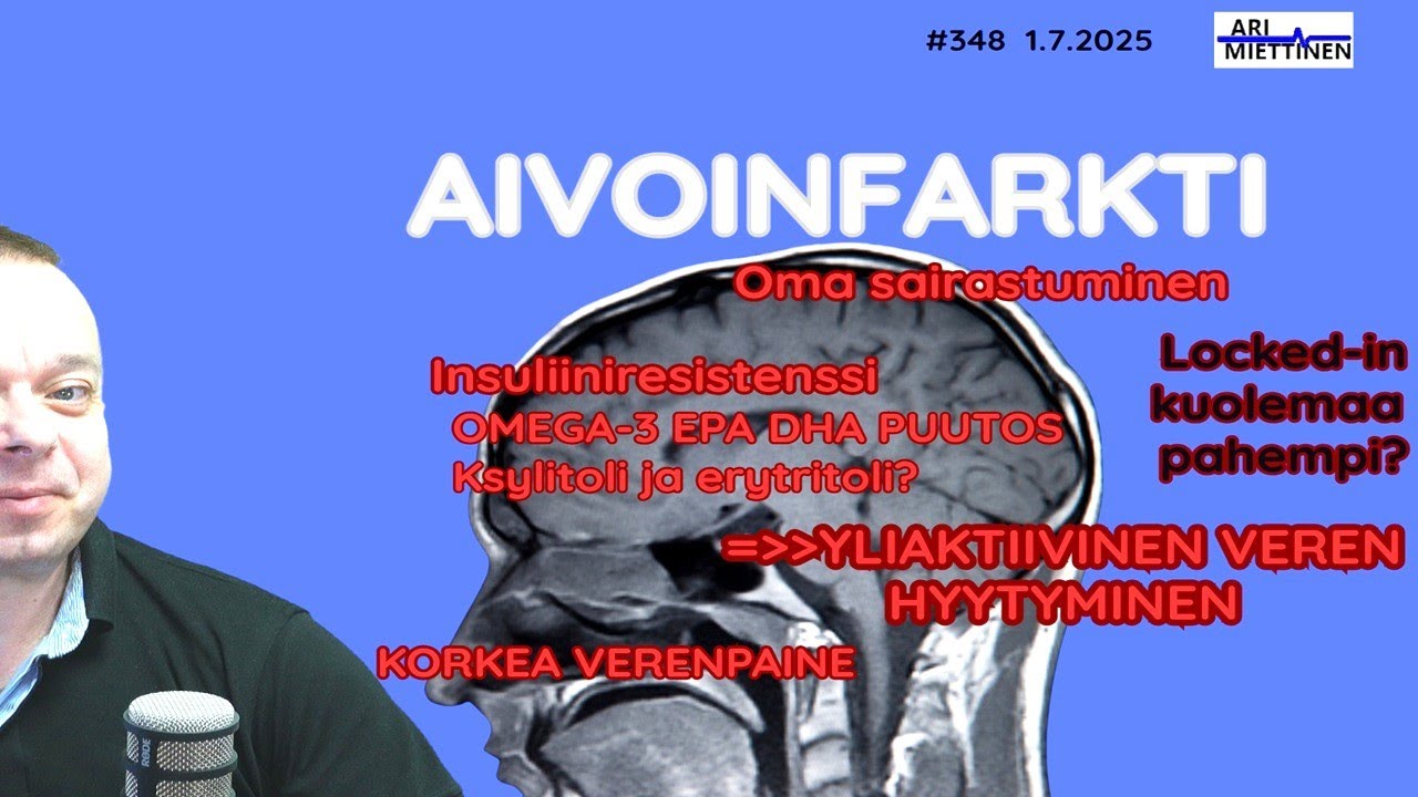 348 Aivoinfarkti usein syynä liian aktiivinen veren hyytyminen