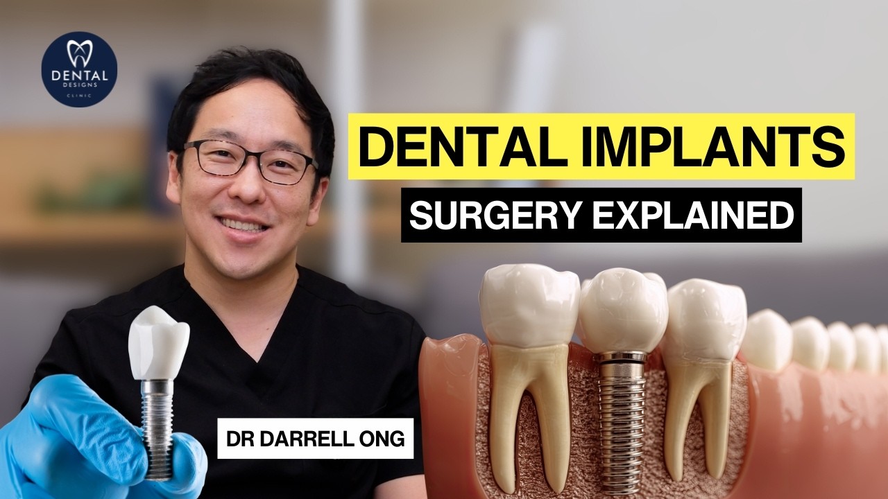 Dental Implants Procedure Explained: The Entire Treatment Schedule