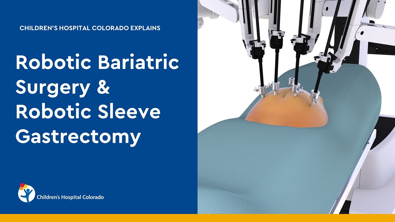 Robotic Bariatric Surgery