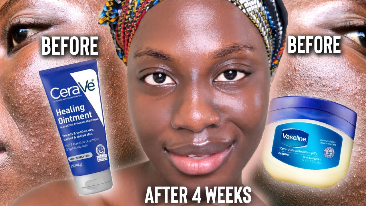 I USED VASELINE/CERAVE HEALING OINTMENT ON MY FACE EVERYDAY FOR 4 WEEKS  | I’M SOO SHOCKED 😱🤭💦