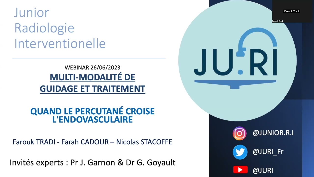 Webinar du JURI: Radiologie Interventionnelle multimodale: l'endovasculaire au service du percutané!
