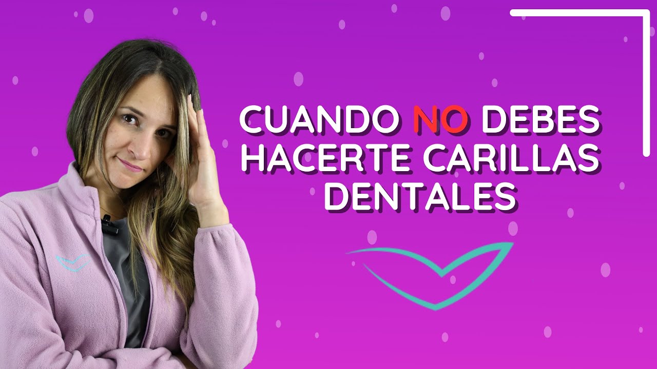 Cuando NO debes hacerte carillas dentales