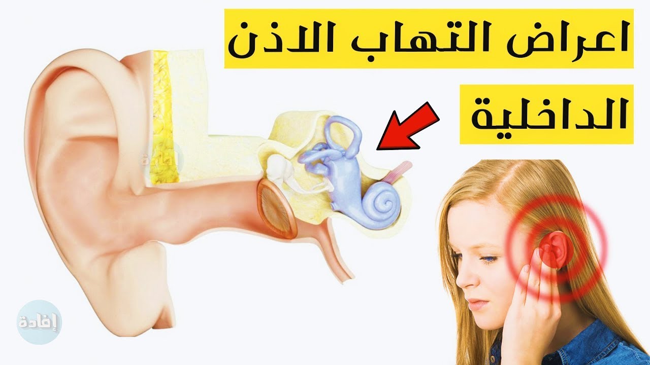 علاج التهابات الاذن الوسطي و طنين الاذن و الدوخة المستمرة بطريقة صحيحية وفعالة Otitis media