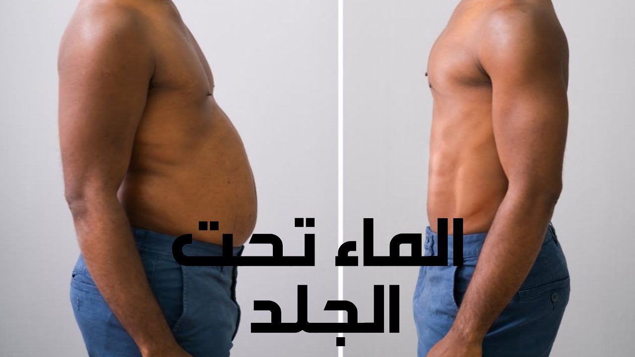الفرق بين الدهون واحتباس الماء🤔