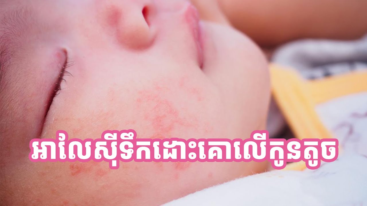 អាលែស៊ីទឹកដោះគោ និងអាលែស៊ីសណ្ដែកលើកូនតូច