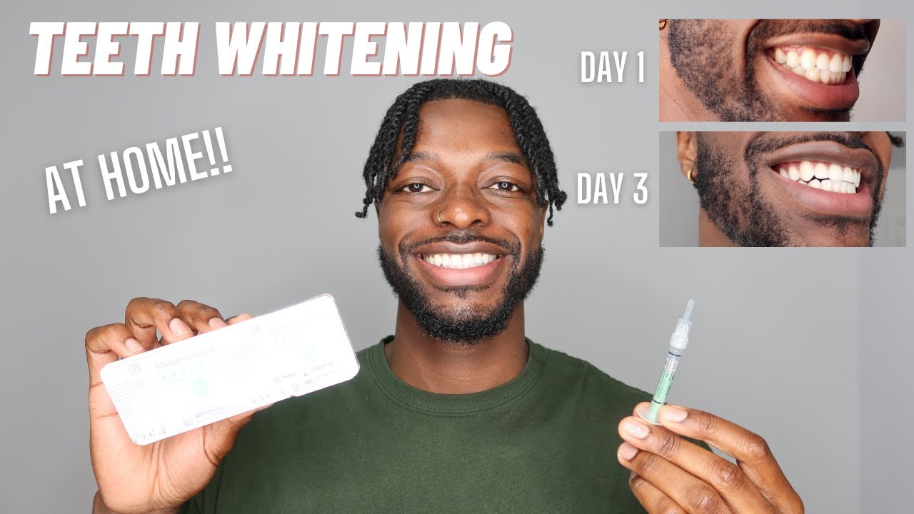 MY TEETH WHITENING ROUTINE AT HOME | OPALESCENCE TEETH WHITENING
