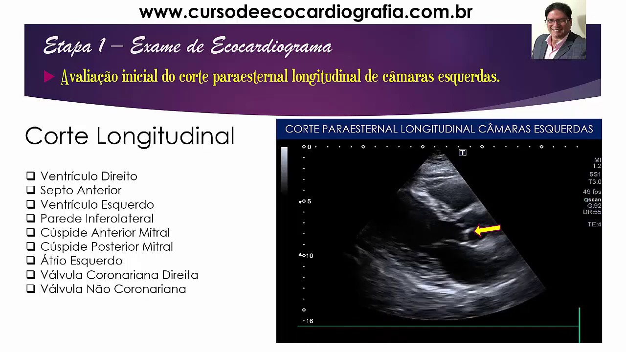 ETAPA 1 -  CORTE LONGITUDINAL