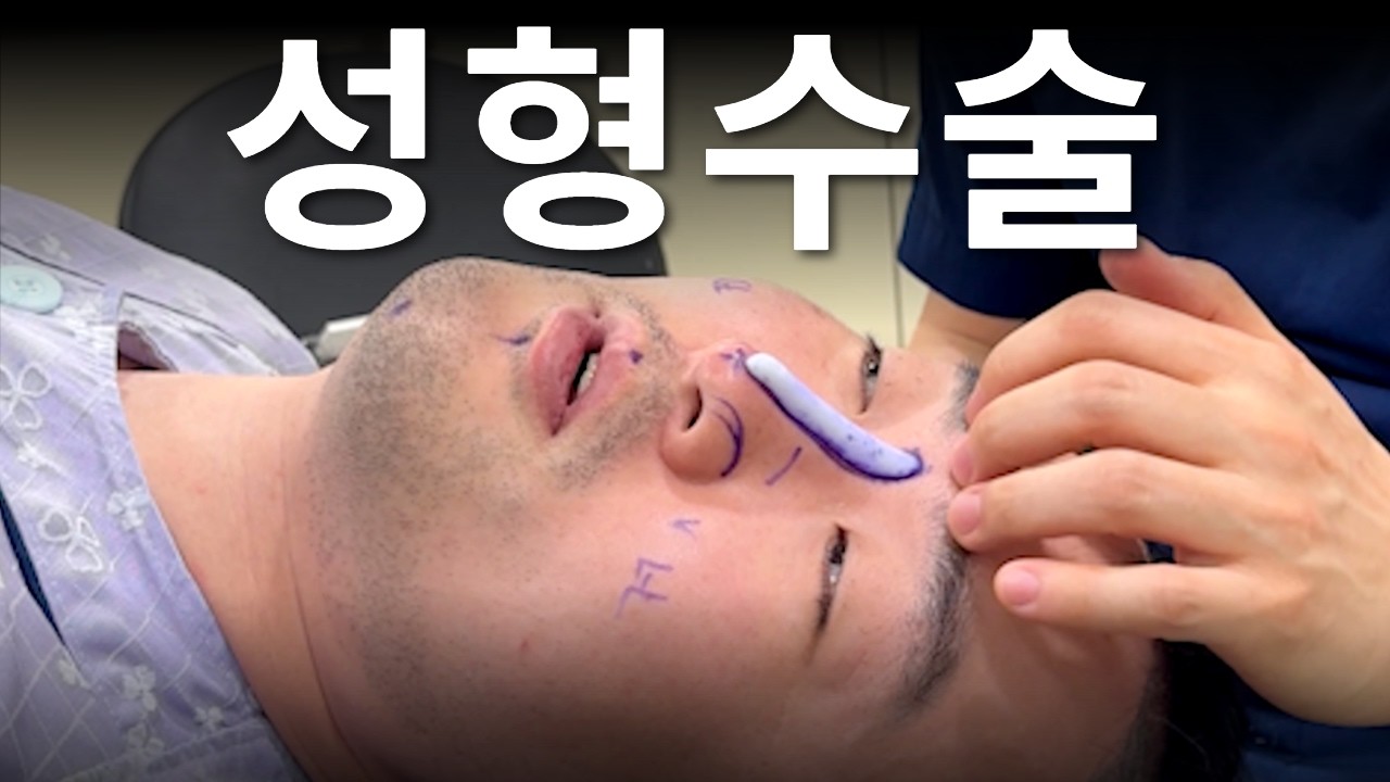 남자눈코 이렇게 수술 합니다. 흐리멍텅 이미지 개선 완료