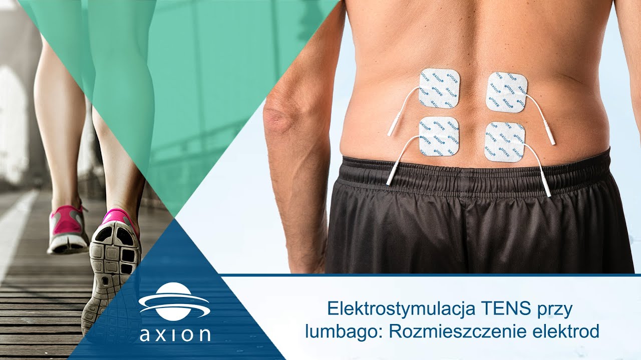 Elektrostymulacja TENS przy lumbago: Rozmieszczenie elektrod