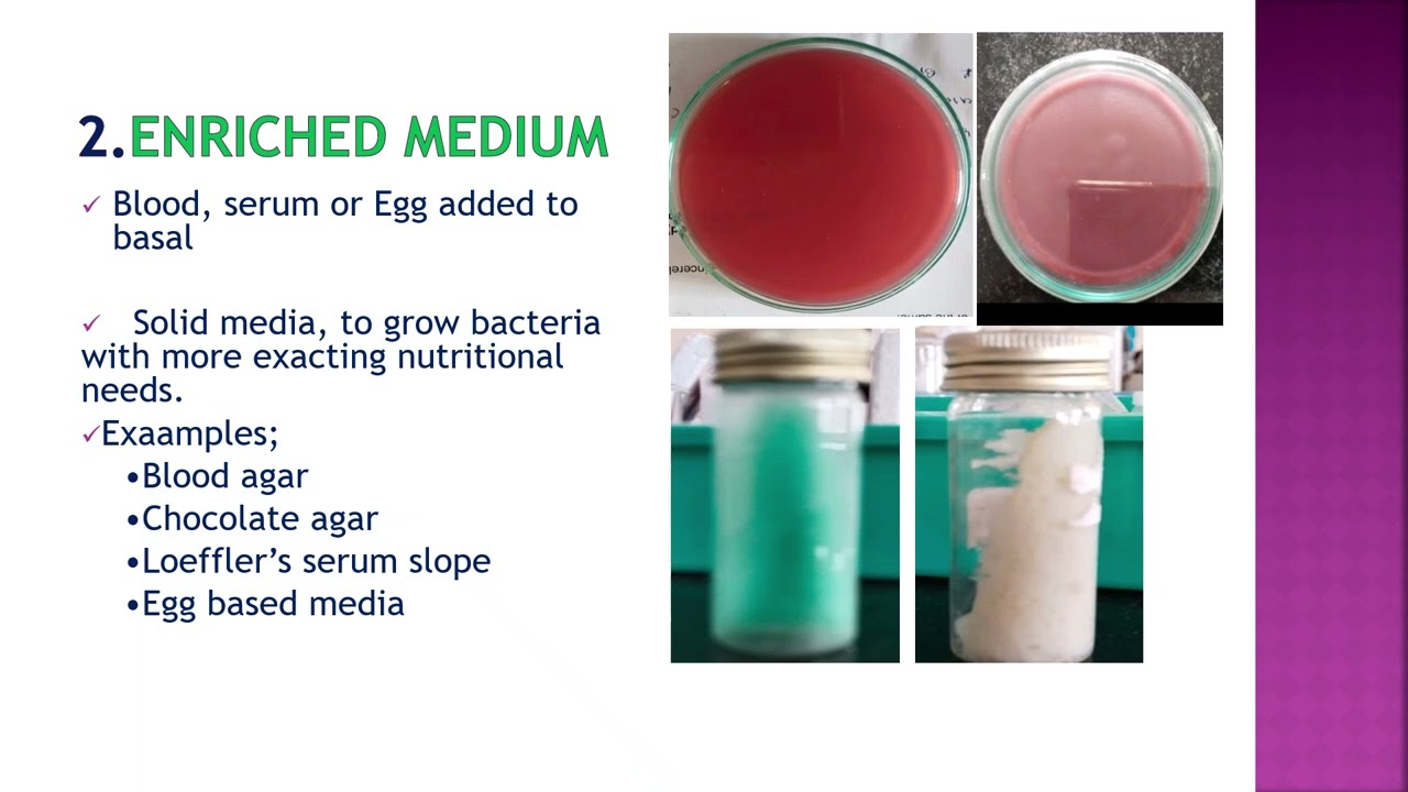 NURSING  2  PHYSIOLOGY OF BACTERIA AND CULTURE MEDIA DR  MUTHA