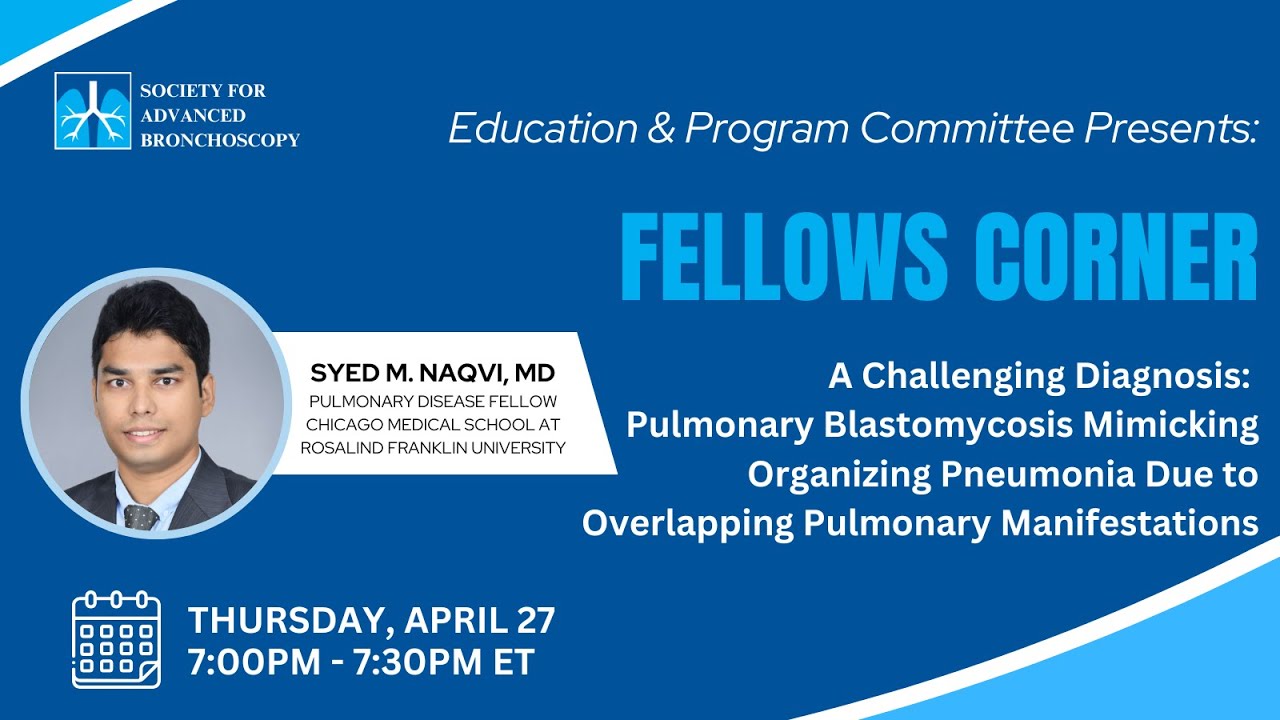 APRIL 2025 | A Challenging Diagnosis Pulmonary Blastomycosis Mimicking Organizing Pneumonia Due
