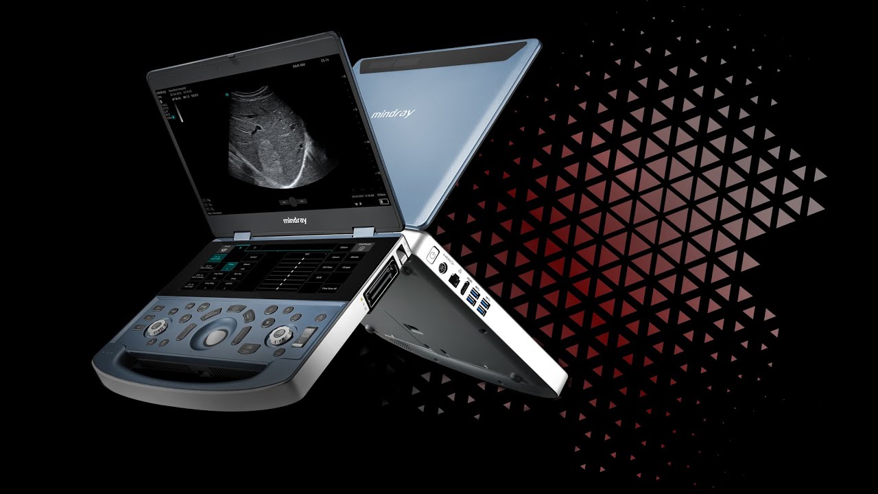 Estudio de Tiroides en Mindray MX7