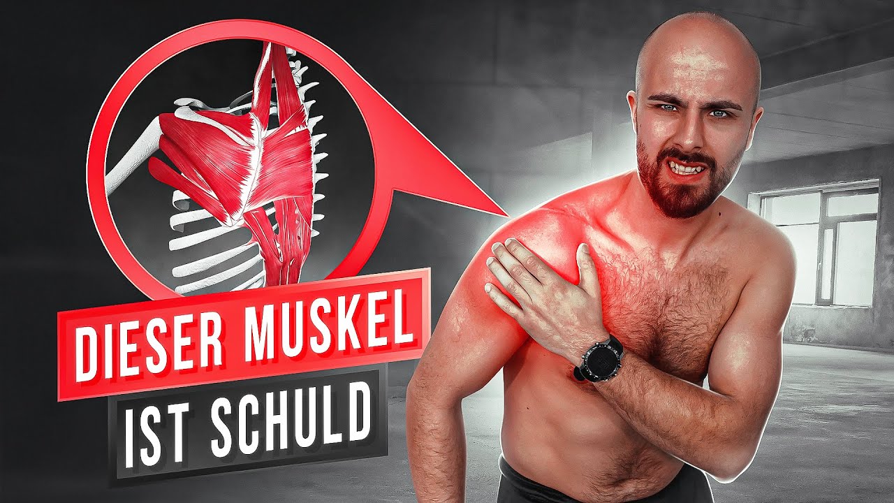 Schulterschmerzen (ist kein Schulterimpingement)