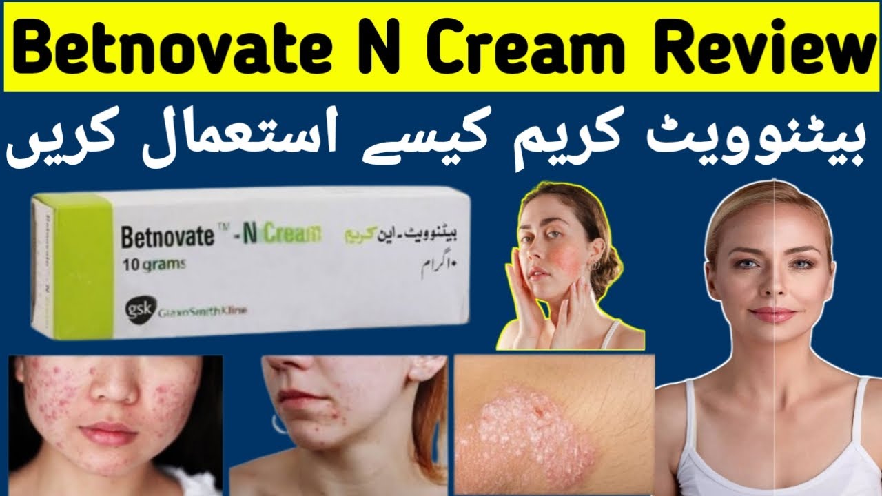 Betnovate n skin cream ke fayde - Betamethasone cream uses & Review in hindi - Side Effect, Benefits