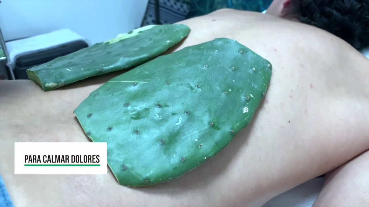 Fitoterapia. 4ª Sesión. Tuna