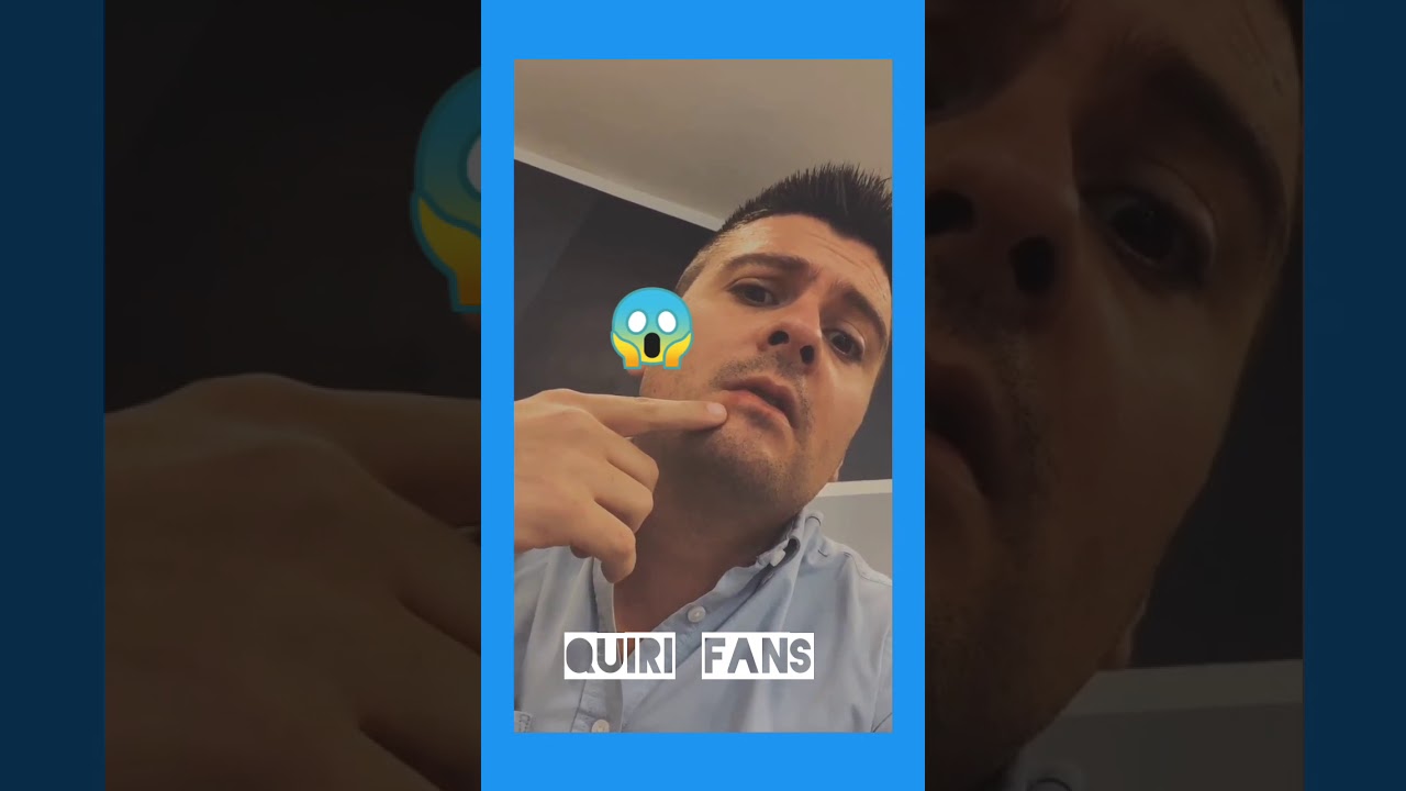 Que le pas&oacute; a Carlos Quirarte 😱