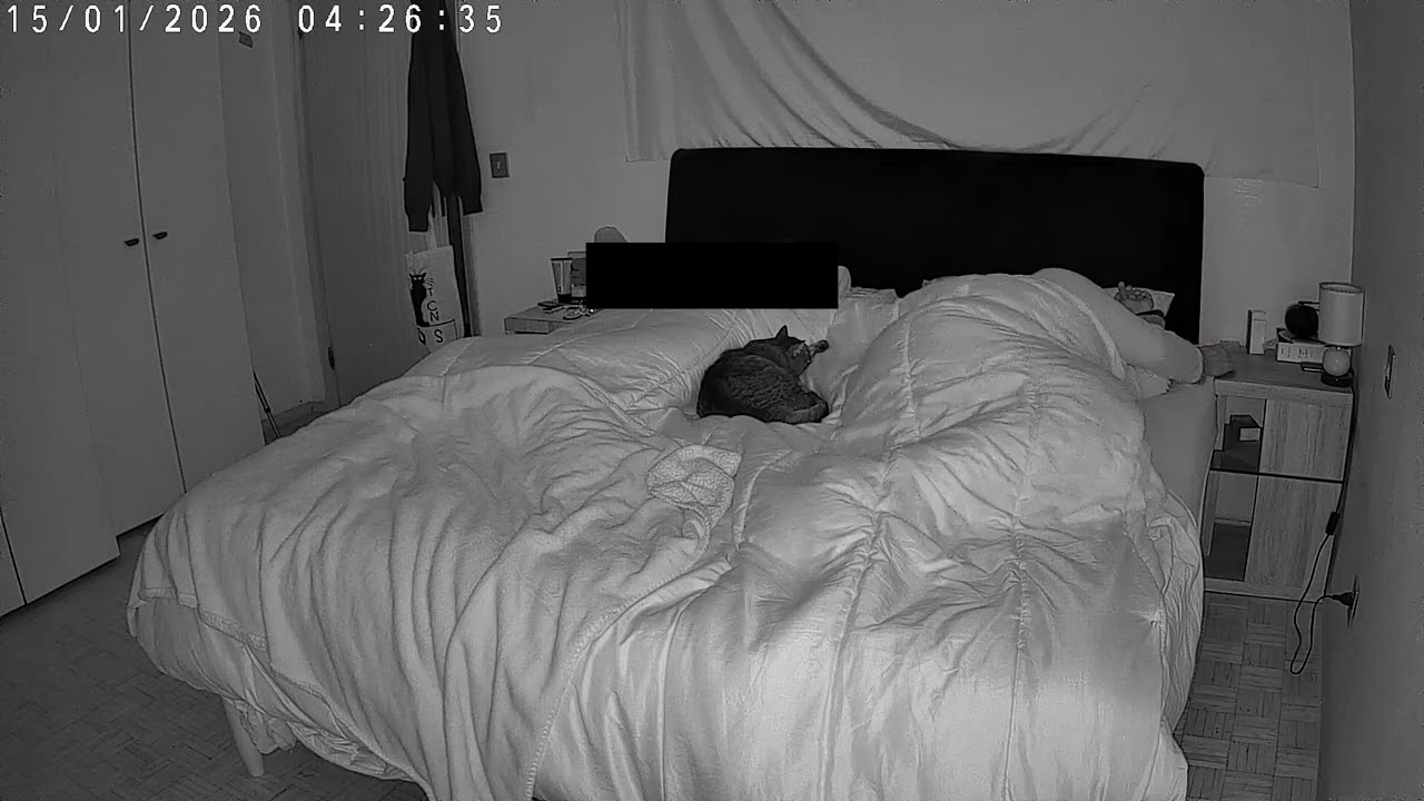 Probable Nightly Focal Epilepsy: lf arm, chest, legs and feet (15/1/2026) #3