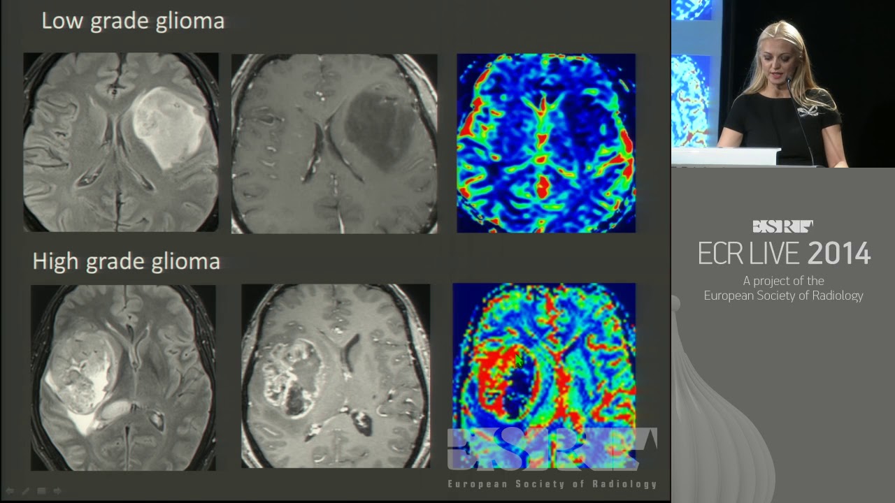 Neuro Basic 2   Basic Session on Neuroradiology 1
