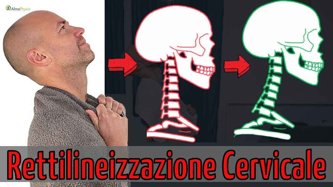 Il MIGLIOR esercizio per la RETTILINEIZZAZIONE CERVICALE