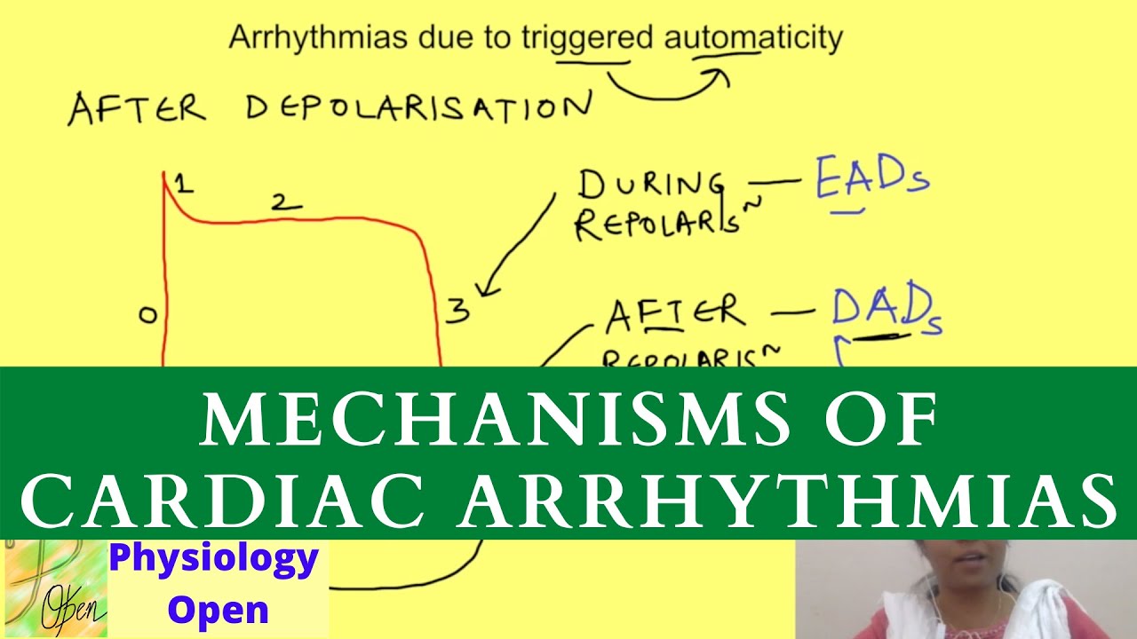 Mechanisms of cardiac arrhythmias | Tachyarrhythmias | Cardiovascular Pathophysiology |