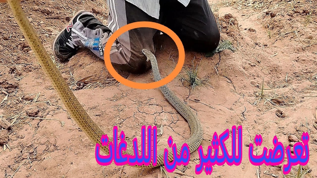 تعرضت للكثير من اللدغات من هذا الثعبان الشرس