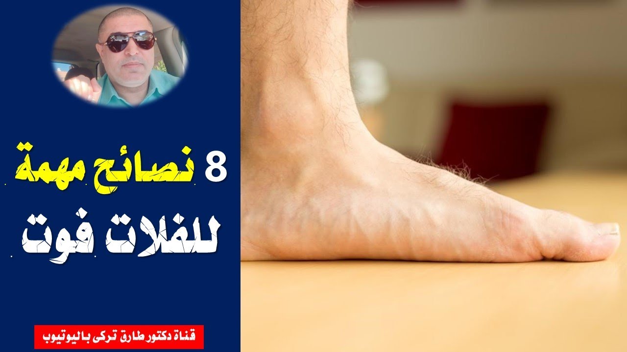 8 نصائح مهمة لمرضى الفلات فوت | لو عندك فلات فوت اية اللى تعملة واية اللى متعملوش