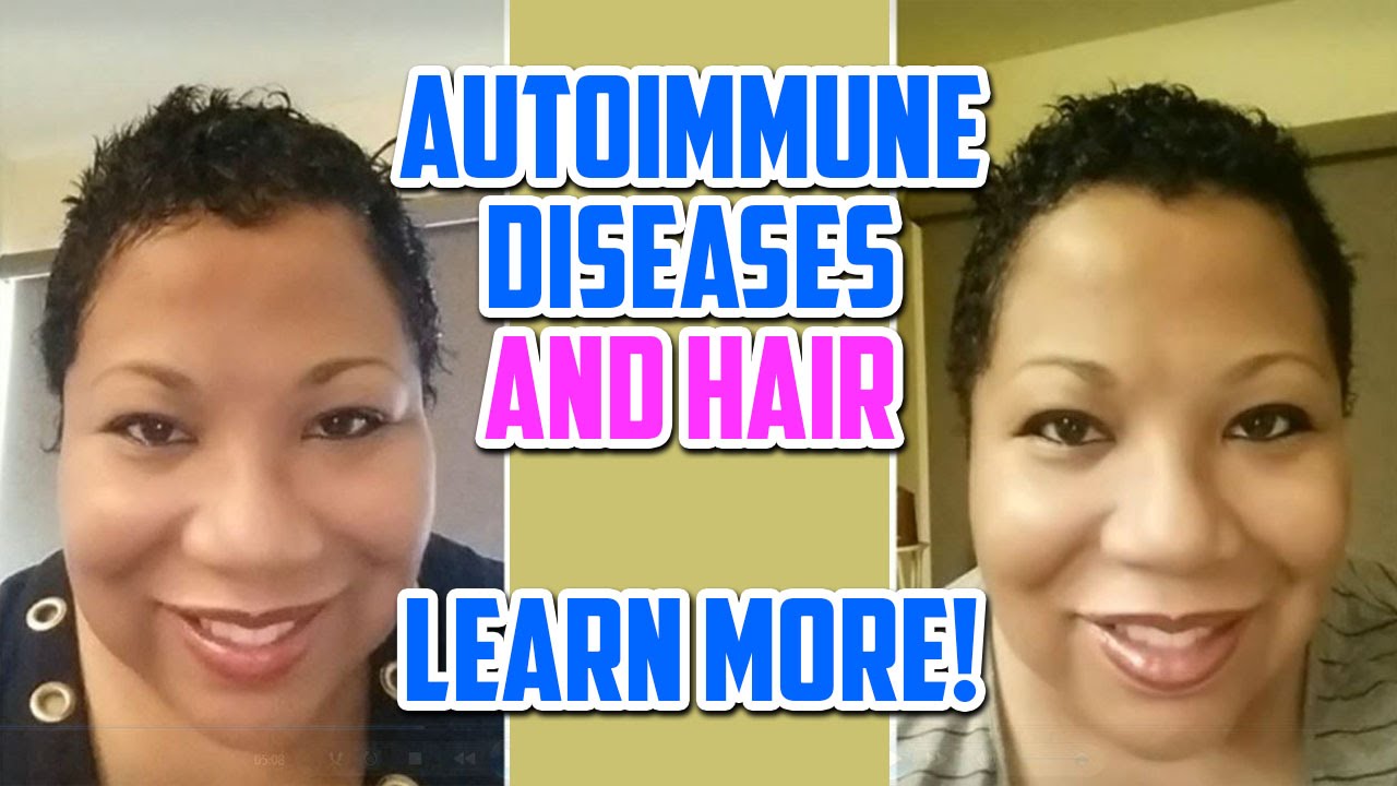 Autoimmune Diseases and My Hair