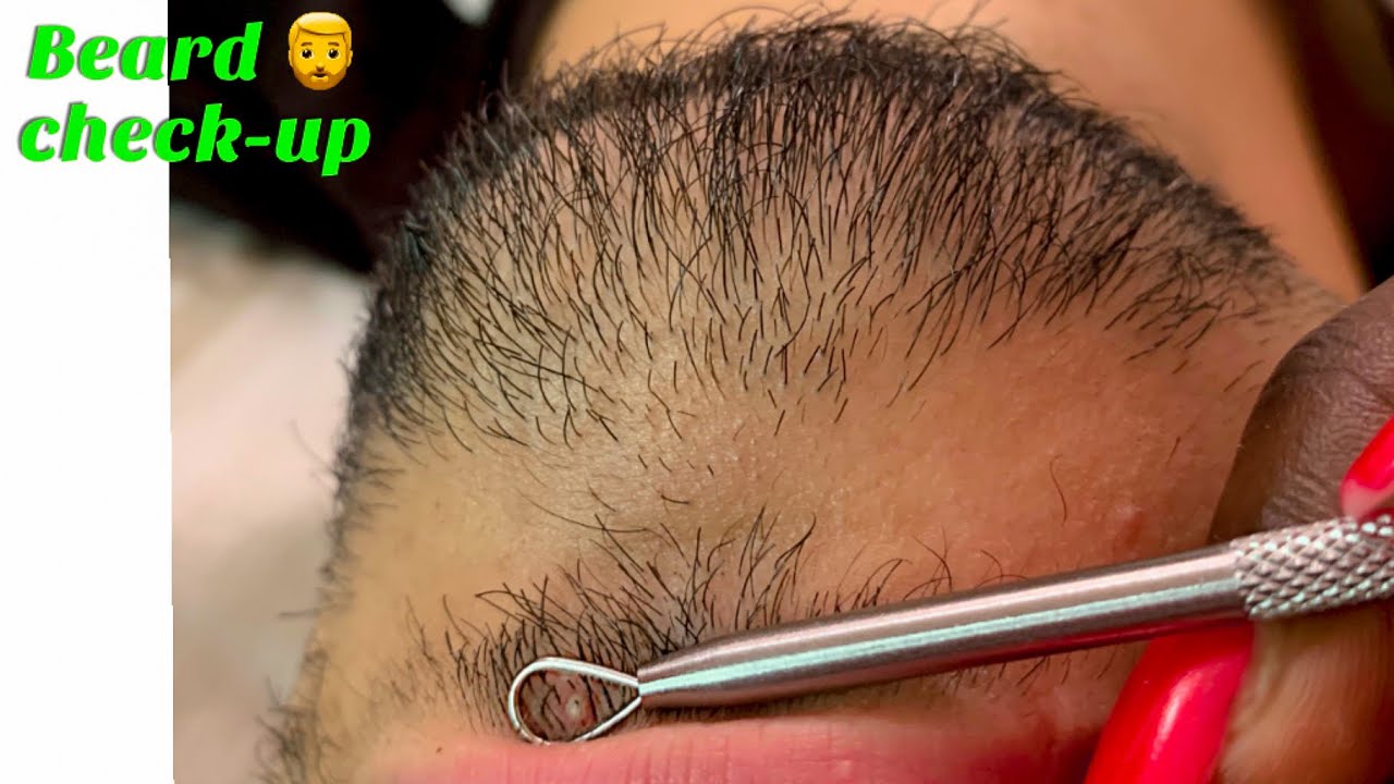 ASMR Allzoomed Beard Picking | Check-Up | Scratching for a peaceful sleep session 😴