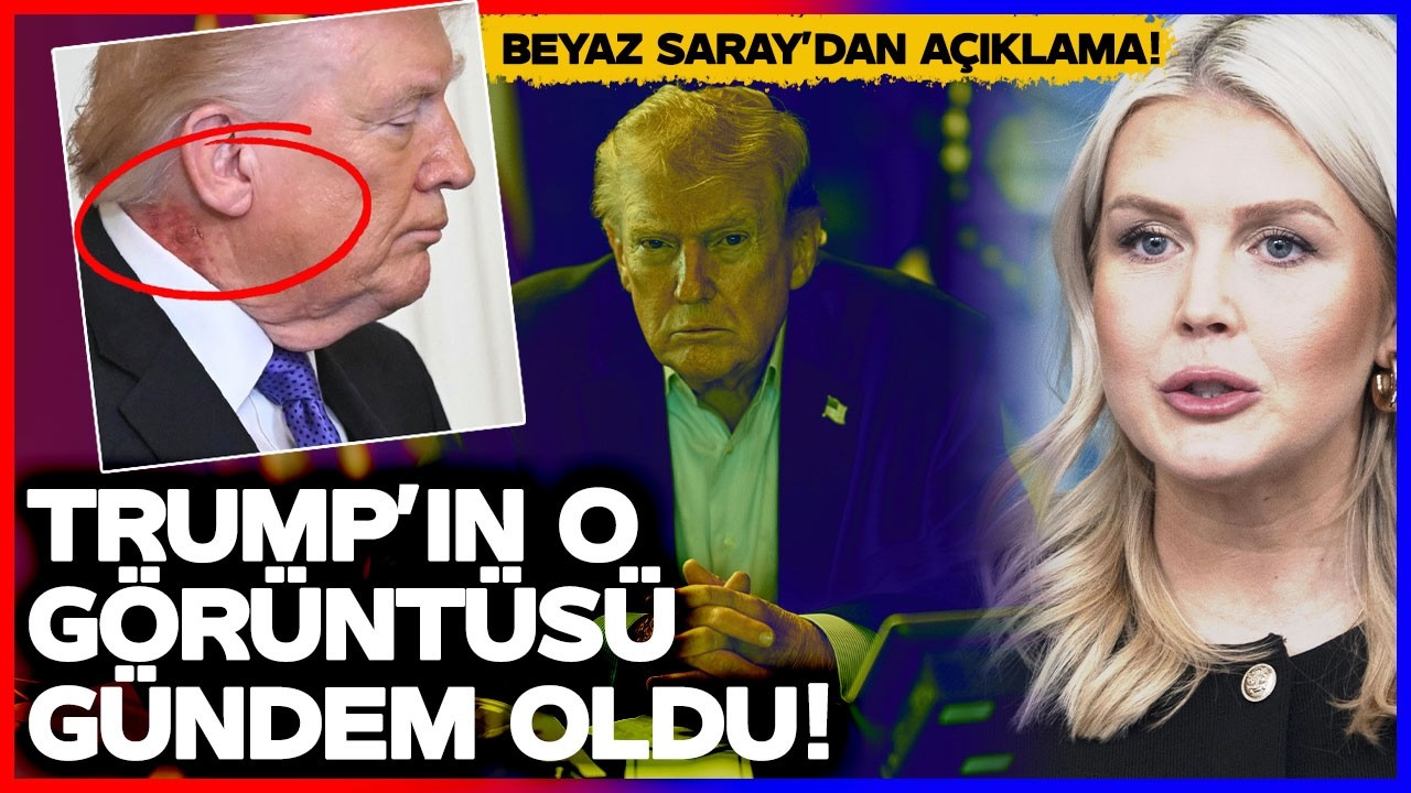 Trump'ın O Görüntüsü Gündem Oldu! Beyaz Saray'dan Açıklama Geldi