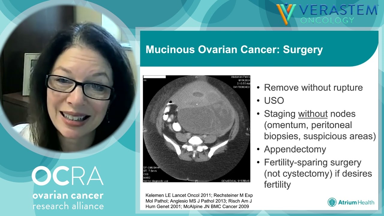 Updates on Rare Ovarian Cancers (2022)