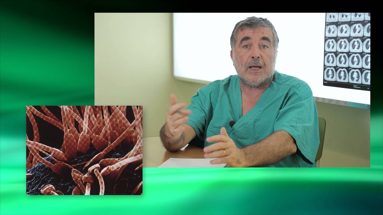 Radiologia Interventistica e trattamento dei Varicocele Maschile