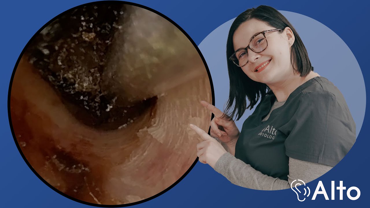&ldquo;It&rsquo;s like having HD hearing&rdquo; | Ear Wax Removal Provides Massive Relief EP032