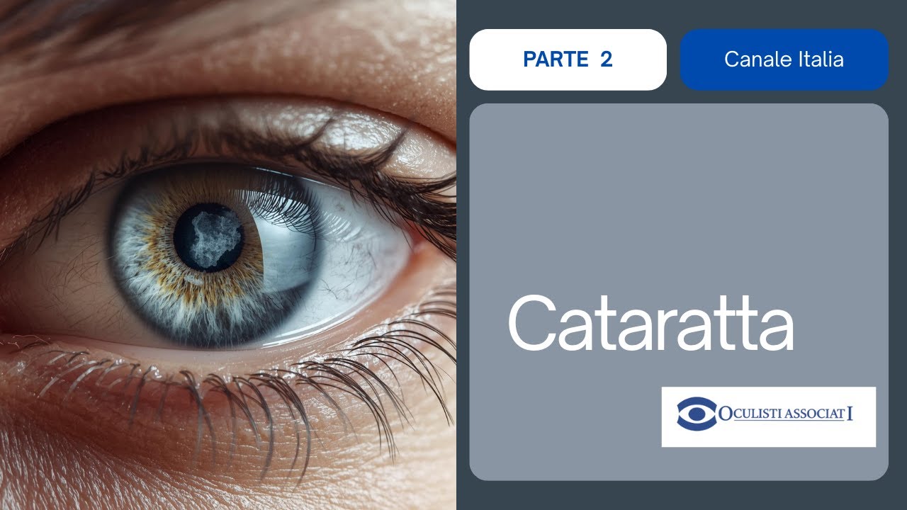 Cataratta : diagnosi, trattamento e nuove tecnologie - dialogo con gli esperti -Parte 2