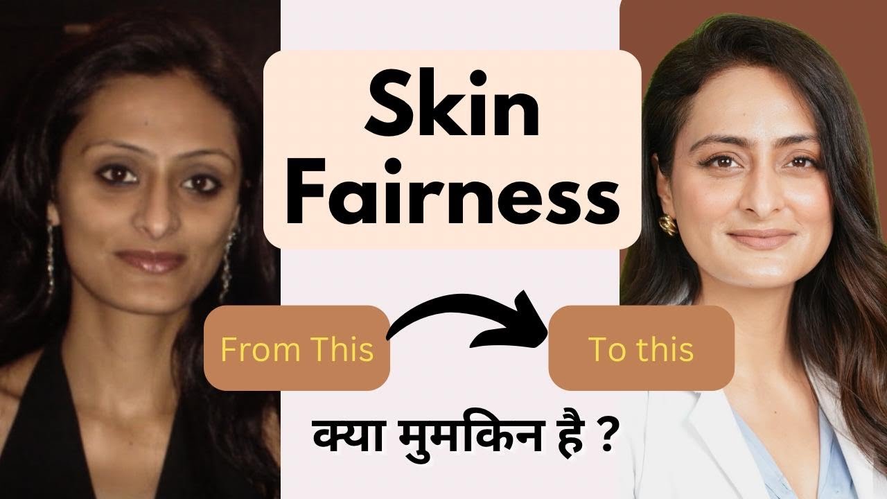 Kya fairness creams kaam karte hai | Fairness cream  | Tvacha ke doctor