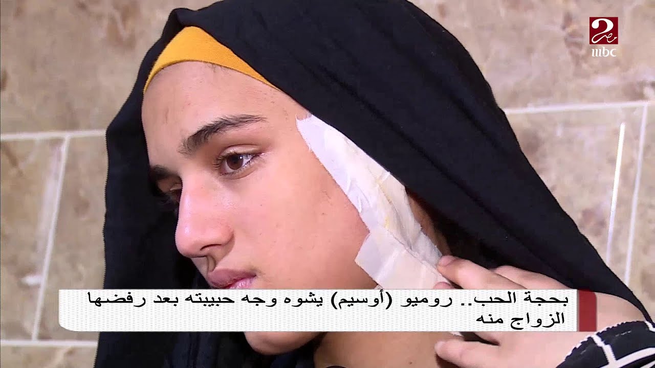 بحجة الحب ..روميو أوسيم يشوه وجه حبيبته بعد رفضها الزواج منه