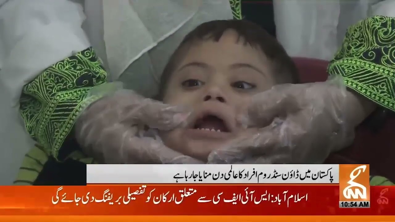 World Down Syndrome Day 2024. GNN News Story of PDSA Pakistan