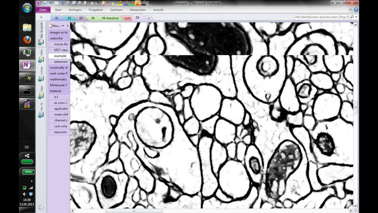 5.1 Watershed | Image Analysis Class 2013