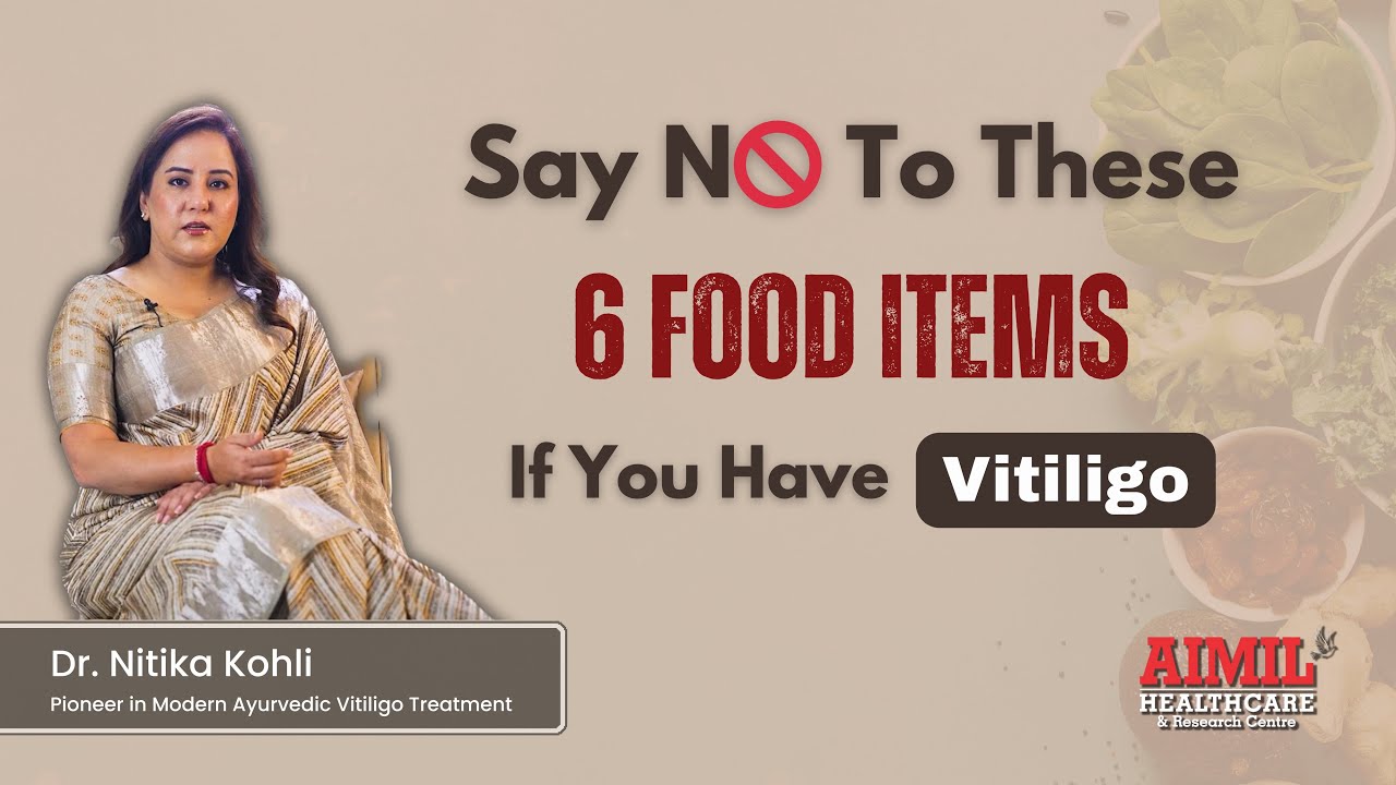 Avoid These 6 Food Items If You Are A Vitiligo (Safed Daag) Patient!